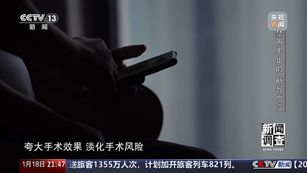 新闻调查丨术后麻MK体育烦不断 禁而不止的“断骨增高” 有多坑？(图11)